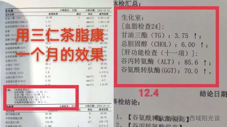 胆管癌术后营养吃什么最好_胆管癌术后的营养餐_术后胆管癌的治愈率是多少